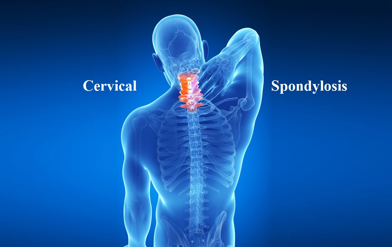 Difference Between Cervical Pain And Spondylitis