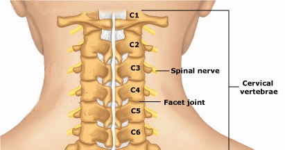 Cervical Spondylosis : Symtoms, Causes and Remedies – Infodrishti